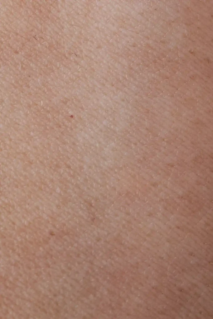 Close-up of human skin texture showing fine lines and pores, illustrating UVA and UVB impact on skincare in compact spaces with sunlight and UV exposure.