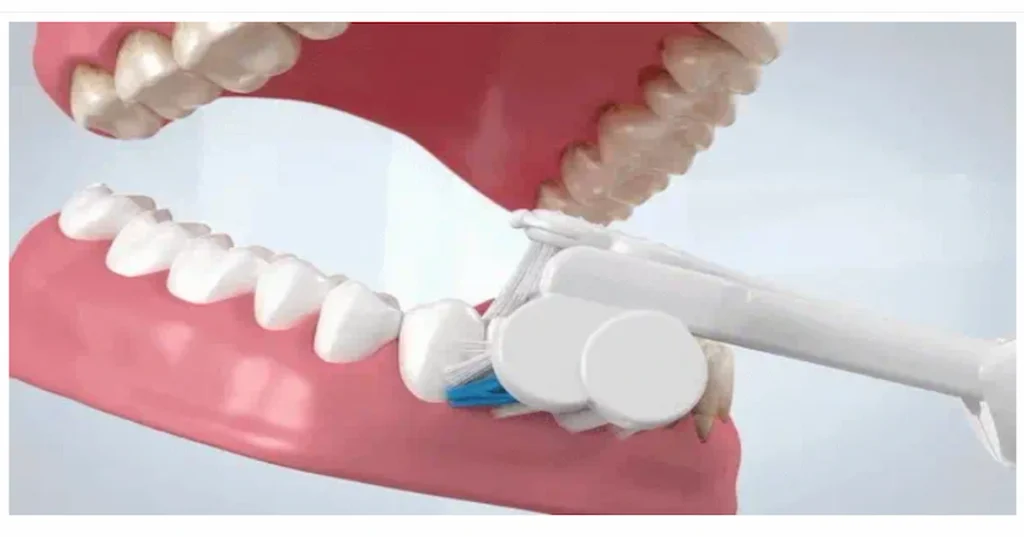 Triple Bristle Max Sonic Toothbrush 3-sided brush head cleaning teeth at a 45-degree angle