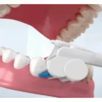 Triple Bristle Max Sonic Toothbrush 3-sided brush head cleaning teeth at a 45-degree angle